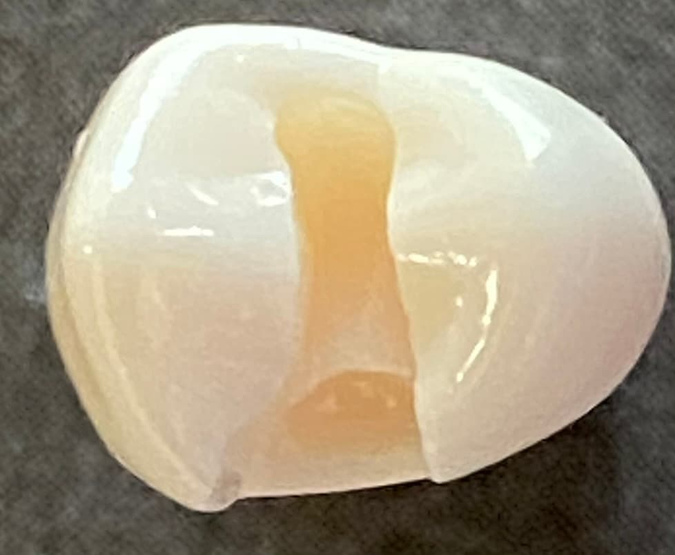 Elite Performance Evaluation