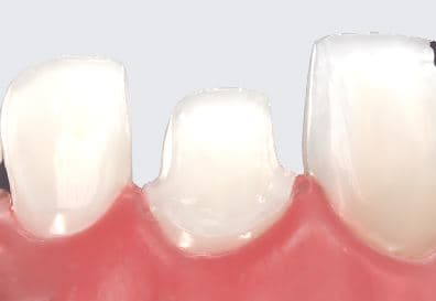 Comprehensive Programs